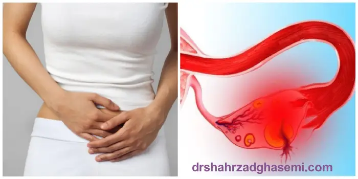 دفع کیست تخمدان چه علائمی دارد